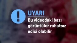 Donetsk’e yapılan topçu saldırılarında can kayıpları